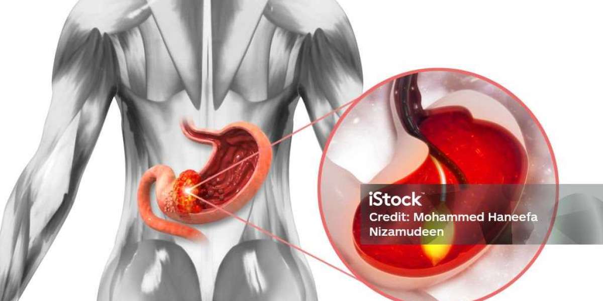 What is Fenbendazole Used For?