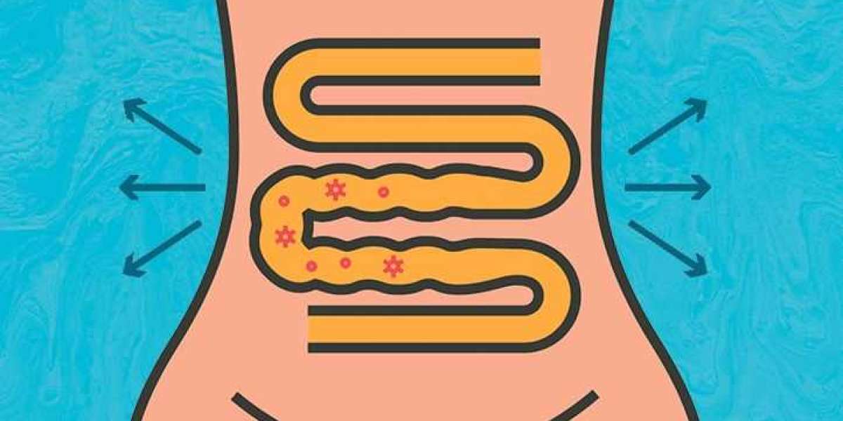 Exploring the Connection Between Stress and Loose Watery Bowel Movements